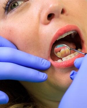 Ortodontie Tg Mures - aparat dentar ceramic